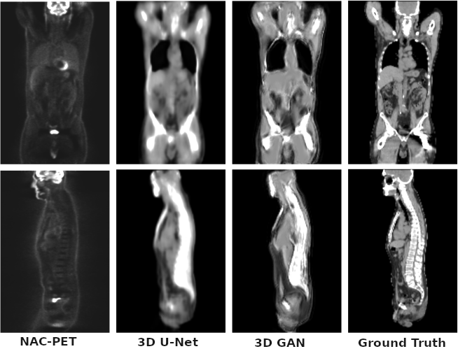 Whole Body PET Attenuation Correction Map Synthesizing using 3D Deep ...