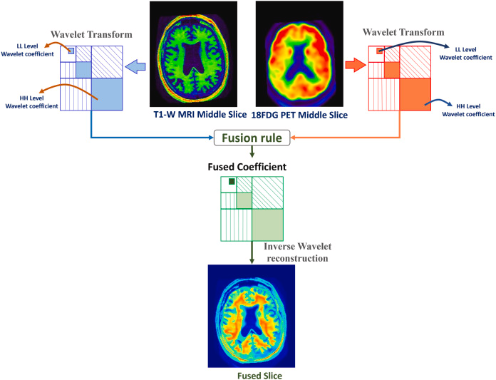 FuseNet: Attention-learning based MRI–PET slice fusion for Alzheimer’s ...